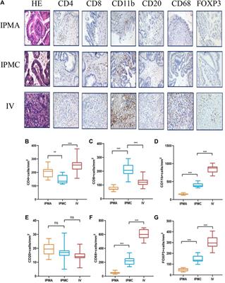 The molecular, immune features, and risk score construction of intraductal papillary mucinous neoplasm patients